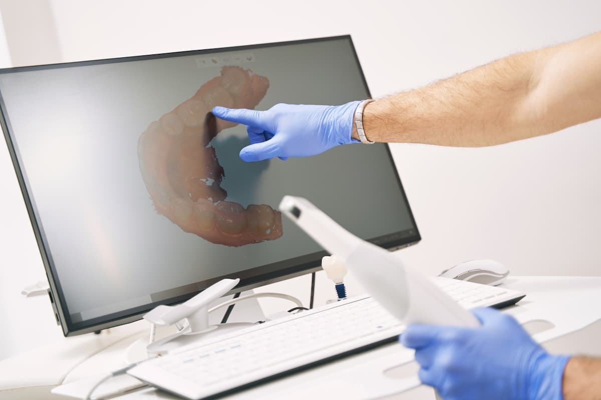 Dental Implants in Istanbul, Turkey – Doctor-Led Treatment for International Patients