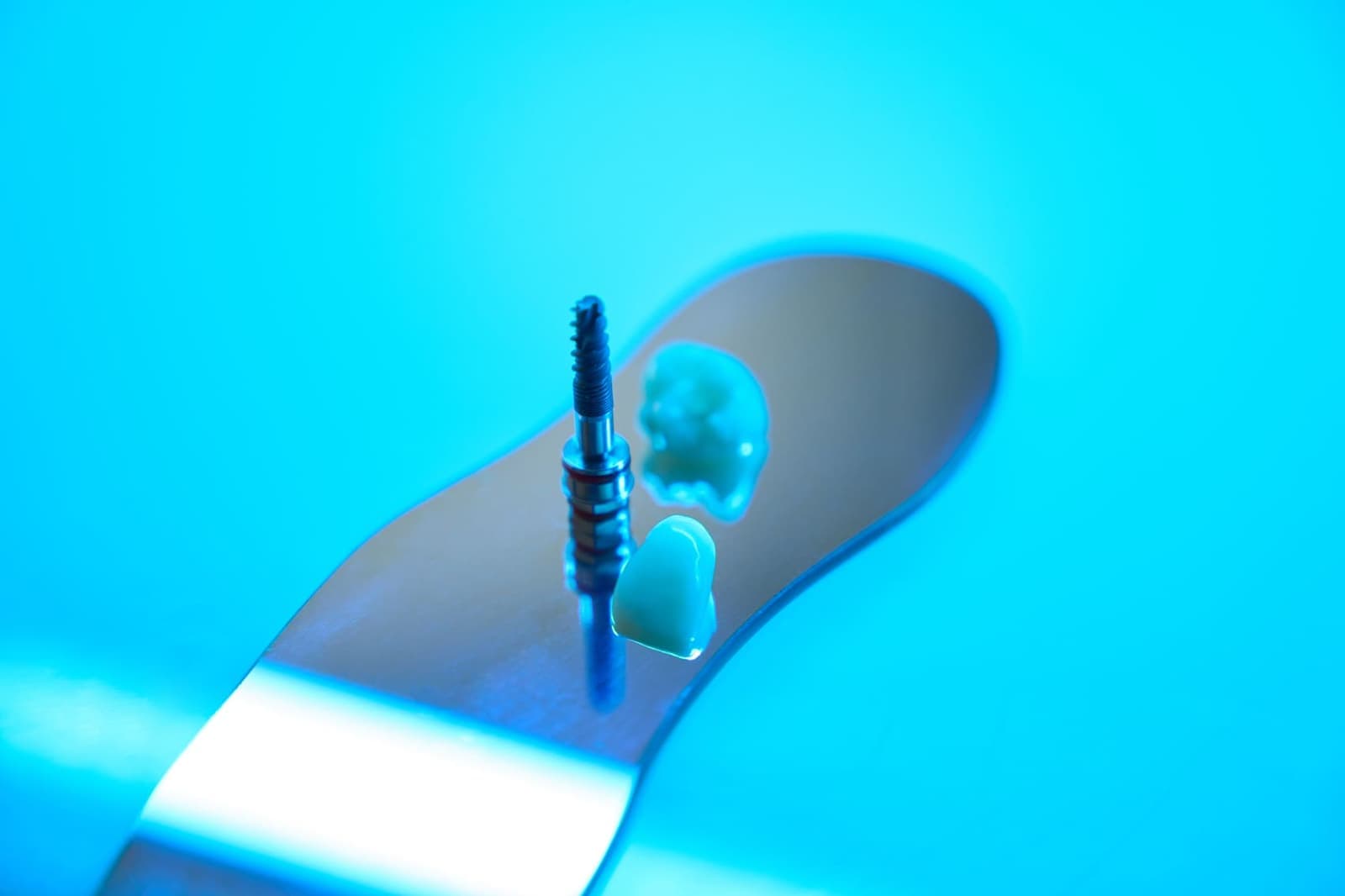 La ce ar trebui să fii atent în primele 24 de ore după operația de implant dentar?